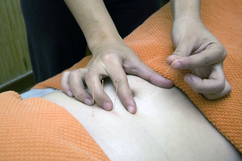 osteopathe-ST ETIENNE DE TINEE-min_acupuncture-4175625